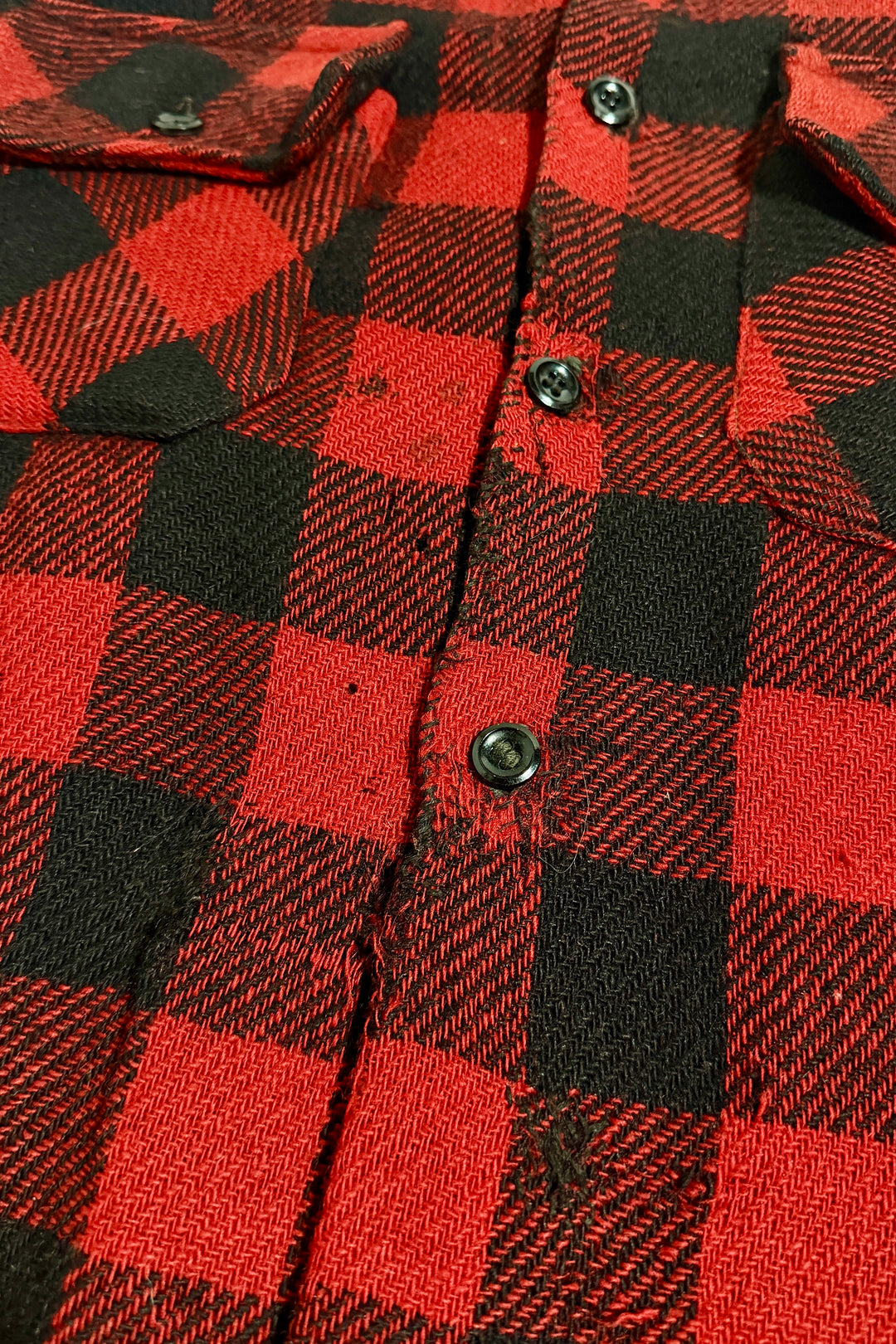 Placket and button detail